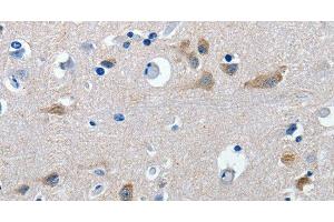 Immunohistochemistry of paraffin-embedded Human brain tissue using GAD2 Polyclonal Antibody at dilution 1:30 (GAD65 anticorps)