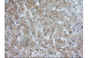 Image no. 2 for anti-Acetyl-CoA Acetyltransferase 2 (ACAT2) antibody (ABIN1496402) (ACAT2 anticorps)