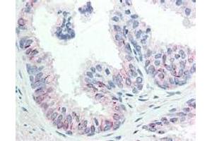 Immunohistochemistry (IHC) image for anti-V-Akt Murine Thymoma Viral Oncogene Homolog 1 (AKT1) (Ser473) antibody (ABIN400784) (AKT1 anticorps  (Ser473))