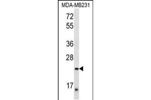 Western blot analysis in MDA-MB231 cell line lysates (35ug/lane). (PEX11A anticorps  (AA 137-165))