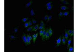 Immunofluorescent analysis of HepG2 cells using ABIN7153857 at dilution of 1:100 and Alexa Fluor 488-congugated AffiniPure Goat Anti-Rabbit IgG(H+L)