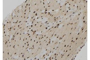 ABIN6279207 at 1/100 staining Mouse heart tissue by IHC-P.