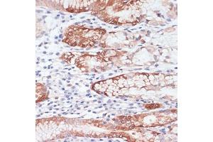 Immunohistochemistry of paraffin-embedded human stomach using Lysozyme (Lysozyme (LYZ)) antibody (ABIN6133802, ABIN6143409, ABIN6143412 and ABIN6217538) at dilution of 1:100 (40x lens). (LYZ anticorps  (AA 1-100))