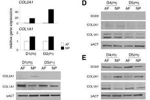 Immunoblot analysis of primary AF and NP cell lysates from two independent donors, D1 (P0) and D3 (P1), respectively, for COL1A1 (ABIN135046) and COL2A1 (ABIN135048).