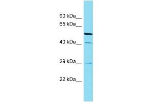 Western Blotting (WB) image for anti-Calcium Binding Protein 4 (CABP4) (C-Term) antibody (ABIN2789662) (CABP4 anticorps  (C-Term))