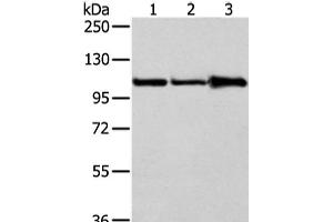Western Blot analysis of A431, 231 and NIH/3T3 cell using AP2A1 Polyclonal Antibody at dilution of 1/250 (alpha Adaptin anticorps)
