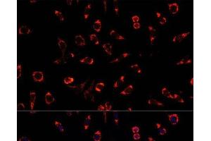 Immunofluorescence analysis of L929 cells using PAH Polyclonal Antibody at dilution of 1:100.