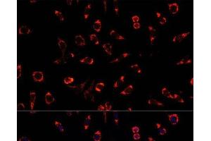 Immunofluorescence analysis of L929 cells using PAH Polyclonal Antibody at dilution of 1:100.