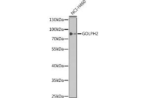 Western blot analysis of extracts of NCI-H460 cells, using GOLPH2 antibody  at 1:1000 dilution. (GOLM1 anticorps)