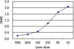 EDN1 (Human) Matched Antibody Pair