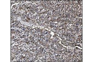 IHC analysis of CD39/ENTPD1 using anti-CD39/ENTPD1 antibody (ABIN7602461).