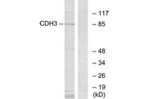 Western blot analysis of extracts from K562 cells, using CDH3 Antibody.