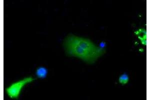Immunofluorescence (IF) image for anti-Bruton Agammaglobulinemia tyrosine Kinase (BTK) antibody (ABIN1496975) (BTK anticorps)