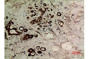 Immunohistochemical analysis of paraffin-embedded human-breast, antibody was diluted at 1:100. (alpha Tubulin anticorps  (acLys40))