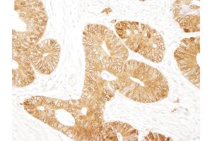 Immunohistochemistry (IHC) image for anti-Catenin, beta (CATNB) (AA 760-781) antibody (ABIN7448432)