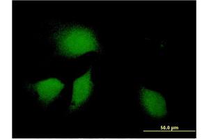 Immunofluorescence of monoclonal antibody to DNAJB9 on HeLa cell. (DNAJB9 anticorps  (AA 114-223))