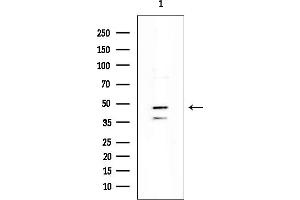 anti-Forkhead Box D2 (FOXD2) antibody