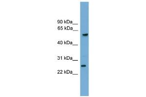 WB Suggested Anti-GZMA Antibody Titration: 0. (GZMA anticorps  (C-Term))