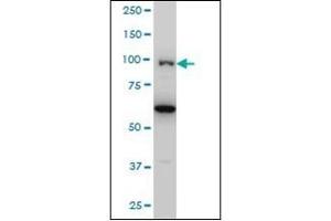 Western Blotting (WB) image for anti-Oculocerebrorenal Syndrome of Lowe (OCRL) (AA 146-240) antibody (ABIN782420) (OCRL anticorps  (AA 146-240))