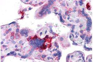 Human Placenta: Formalin-Fixed, Paraffin-Embedded (FFPE)