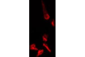 ABIN6274409 staining 293 cells by IF/ICC. (MOBKL1A anticorps  (N-Term))