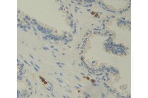 #VALUE! (Photoreceptor Cell Specific Nuclear Receptor anticorps  (AA 1-410))