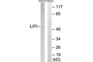Western blot analysis of extracts from COLO cells, using LIPI Antibody. (Lipase I anticorps  (AA 289-338))