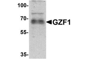 Western blot analysis of GZF1 in human heart tissue lysate with GZF1/ZNF336 Antibody  at 1 µg/ml.