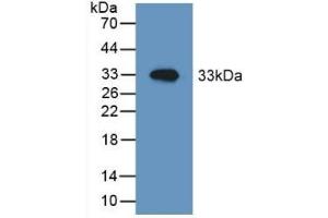 Detection of Recombinant HSPD1, Mouse using Polyclonal Antibody to Heat Shock Protein 60 (Hsp60)