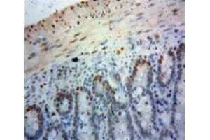 Used in DAB staining on fromalin fixed paraffin-embedded Bowels tissue (SIRT6 anticorps  (AA 35-274))