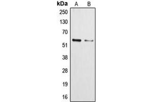 Western blot analysis of Cytochrome P450 3A4/5 expression in NCIH460 (A), HepG2 (B) whole cell lysates. (Cytochrome P450 3A4, 3A5 (Center) anticorps)