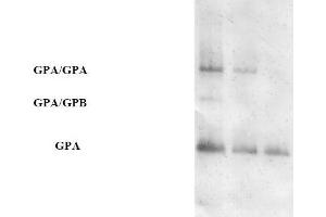 Western blot analysis using AP31671PU-N (Purified Anti-Glycophorin A pAb) at a dilution of 1/100 on human RBCs at various concentrations (GPA = Glycophorin A, GPB = Glycophorin B). (CD235a/GYPA anticorps)