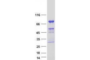 Validation with Western Blot