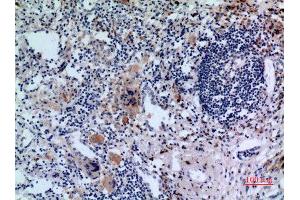 Immunohistochemistry (IHC) analysis of paraffin-embedded Human Lung, antibody was diluted at 1:100.