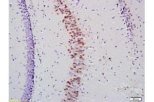 Formalin-fixed and paraffin embedded mouse hippocampus labeled with Anti- KLK10 Polyclonal Antibody, Unconjugated (ABIN741630) at 1:200 followed by conjugation to the secondary antibody (Kallikrein 10 anticorps  (AA 65-165))