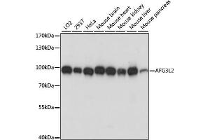Western blot analysis of extracts of various cell lines, using L2 antibody (ABIN7265513) at 1:1000 dilution. (AFG3L2 anticorps  (AA 538-797))