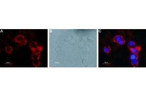 Expression of mGluR4 in rat PC12 cells - Cell surface detection of mGluR4 in live intact rat PC12 pheochromocytoma cells.