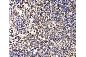 Immunohistochemistry of paraffin-embedded Rat spleen using WBSCR22 Polyclonal Antibody at dilution of 1:100 (40x lens). (WBSCR22 anticorps)