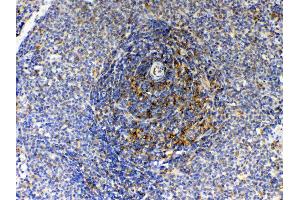 IHC analysis of GAS 6 using anti- GAS 6 antibody .