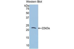 Western Blotting (WB) image for anti-Tumor Protein, Translationally-Controlled 1 (TPT1) (AA 1-172) antibody (ABIN1078636)