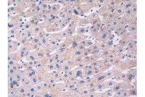 Detection of FBLN1 in Human Liver Tissue using Polyclonal Antibody to Fibulin 1 (FBLN1)