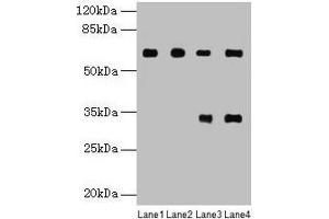 Western blot All lanes: PGM1 antibody at 6 μg/mL Lane 1: U251 whole cell lysate Lane 2: U937 whole cell lysate Lane 3: Jurkat whole cell lysate Lane 4: Hela whole cell lysate Secondary Goat polyclonal to rabbit IgG at 1/10000 dilution Predicted band size: 62, 64, 41 kDa Observed band size: 62 kDa (Phosphoglucomutase 1 anticorps  (AA 1-562))