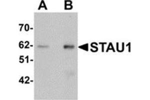 Western blot analysis of STAU1 in rat brain tissue lysate with STAU1 antibody at (A) 1 and (B) 2 μg/ml. (STAU1/Staufen anticorps  (C-Term))