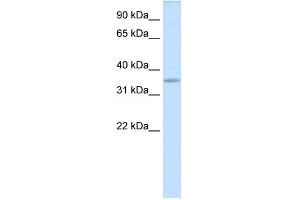 WB Suggested Anti-TGIFX1 Antibody Titration:  0. (TGIF2LX anticorps  (Middle Region))
