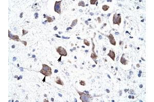 CLCN3 antibody was used for immunohistochemistry at a concentration of 4-8 ug/ml to stain Neural cells (arrows) in Human Brain. (CLCN3 anticorps  (C-Term))