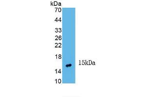 Detection of Recombinant INHbA, Human using Monoclonal Antibody to Inhibin Beta A (INHbA) (INHBA anticorps  (AA 311-426))
