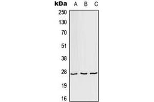 Western blot analysis of AKR1A1 expression in HeLa (A), Raw264. (AKR1A1 anticorps  (C-Term))