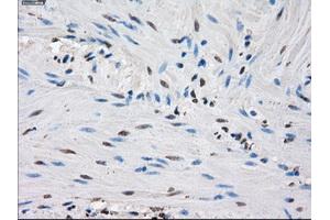 Immunohistochemical staining of paraffin-embedded endometrium tissue using anti-IDH1 mouse monoclonal antibody. (IDH1 anticorps)
