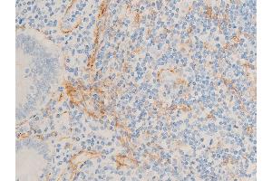 ABIN6267068 at 1/100 staining human appendiceal tissue sections by IHC-P.