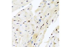 Immunohistochemistry of paraffin-embedded mouse heart using ZBTB17 antibody at dilution of 1:100 (x40 lens). (ZBTB17 anticorps)